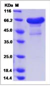 SDS-PAGE - Recombinant Mouse TNRC5 protein (Fc Chimera) (AB276990)