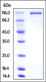 SDS-PAGE - Recombinant Mouse Transferrin Receptor 2/TFR2 protein (Fc Chimera) (AB221026), expandable thumbnail