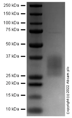 SDS-PAGE - Recombinant Mouse TREM2 protein (AB290832)