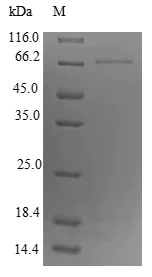 SDS-PAGE - Recombinant Mouse TRP2/DCT protein (His tag) (AB224868)