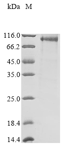 SDS-PAGE - Recombinant Mouse TRPC1 protein (AB289770)