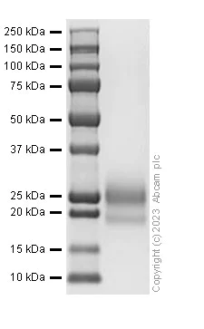 SDS-PAGE - Recombinant Mouse TSLP Protein (His tag) (AB310786)