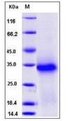 SDS-PAGE - Recombinant Mouse TWSG1/TSG protein (His tag) (AB276779), expandable thumbnail