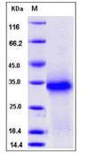 SDS-PAGE - Recombinant Mouse TWSG1/TSG protein (His tag) (AB276779)