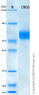 SDS-PAGE - Recombinant Mouse Uromodulin Protein Standard (His tag) (AB316607), expandable thumbnail
