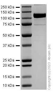 SDS-PAGE - Recombinant Mouse VCAM1 Protein (Fc Chimera) (AB310806), expandable thumbnail