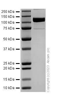 SDS-PAGE - Recombinant Mouse VCAM1 Protein (Fc Chimera) (AB310806)