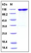 SDS-PAGE - Recombinant Mouse VCAM1 protein (Fc Chimera His Tag) (AB276780), expandable thumbnail