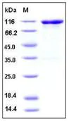 SDS-PAGE - Recombinant Mouse VCAM1 protein (Fc Chimera His Tag) (AB276780)