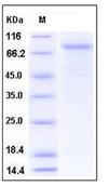 SDS-PAGE - Recombinant Mouse VE Cadherin protein (His tag) (AB276791)