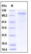 SDS-PAGE - Recombinant Mouse VE Cadherin protein (His tag) (AB276791)