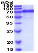 SDS-PAGE - Recombinant Mouse VE Cadherin protein (His tag C-Terminus) (AB208314)