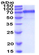 SDS-PAGE - Recombinant Mouse VE Cadherin protein (AB208314)