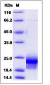 SDS-PAGE - Recombinant Mouse VEGFD protein (His tag) (AB276778)