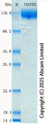 SDS-PAGE - Recombinant Mouse VEGFR2 Protein Standard (His tag) (AB316711)
