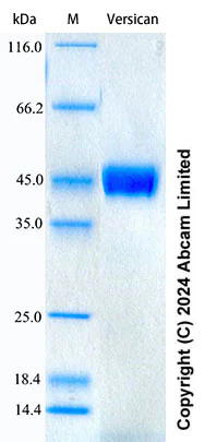 SDS-PAGE - Recombinant Mouse Versican Protein Standard (His tag) (AB322748)