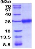 SDS-PAGE - Recombinant Mouse VISTA protein (AB208315), expandable thumbnail