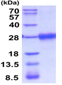 SDS-PAGE - Recombinant Mouse VISTA protein (AB208315)