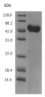 SDS-PAGE - Recombinant Mouse Vitamin D Binding protein (His tag) (AB235708)