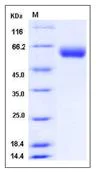 SDS-PAGE - Recombinant Mouse VNN1/Vanin-1 protein (His tag) (AB276948)