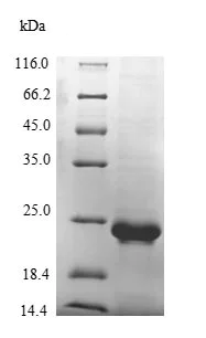 SDS-PAGE - Recombinant Mouse Von Willebrand Factor protein (Tagged) (AB236205)