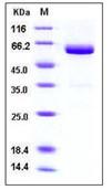 SDS-PAGE - Recombinant Mouse VSIG4 protein (Fc Chimera His Tag) (AB276790), expandable thumbnail