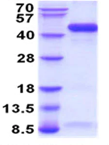 SDS-PAGE - Recombinant Mouse WIF1 protein (His tag C-Terminus) (AB208465)