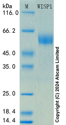 SDS-PAGE - Recombinant Mouse WISP1 Protein Standard (AB316699), expandable thumbnail