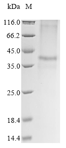 SDS-PAGE - Recombinant Mouse ZnT-8 protein (AB289758), expandable thumbnail