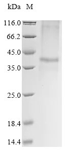 SDS-PAGE - Recombinant Mouse ZnT-8 protein (AB289758)
