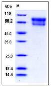 SDS-PAGE - Recombinant Mouse ZPI protein (His tag) (AB276812)