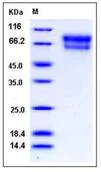 SDS-PAGE - Recombinant Mouse ZPI protein (His tag) (AB276812)