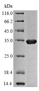 Recombinant Mycobacterium tuberculosis Ag85 protein (His tag)