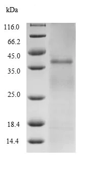 SDS-PAGE - Recombinant Mycobacterium tuberculosis Ag85 protein (His tag) (AB236183)