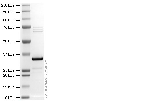 SDS-PAGE - Recombinant Mycobacterium tuberculosis CDC1551 Ag85 Protein (His tag) (AB318949), expandable thumbnail