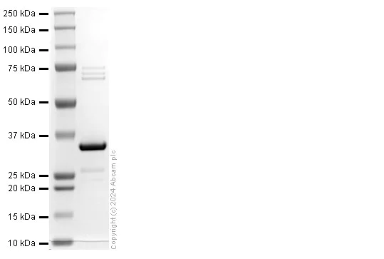 SDS-PAGE - Recombinant Mycobacterium tuberculosis CDC1551 Ag85 Protein (His tag) (AB318949)