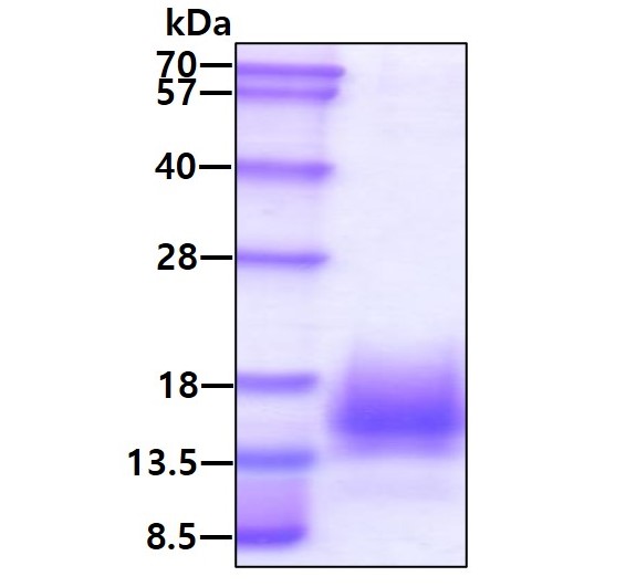 SDS-PAGE - Recombinant Mycobacterium tuberculosis ESAT6 protein (His tag C-Terminus) (AB124574)