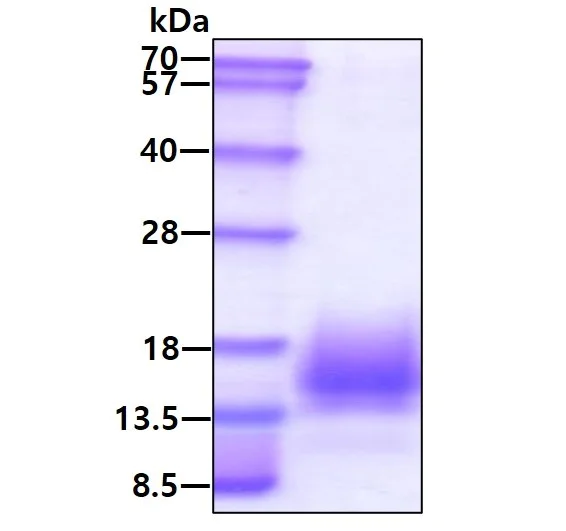 SDS-PAGE - Recombinant Mycobacterium tuberculosis ESAT6 protein (His tag C-Terminus) (AB124574)