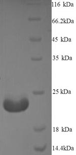 SDS-PAGE - Recombinant Mycobacterium tuberculosis MPT64 protein (His tag) (AB226277)