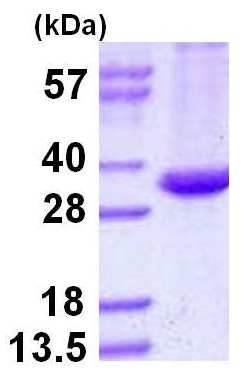 SDS-PAGE - Recombinant Mycobacterium tuberculosis TB Ag85A protein (AB124604), expandable thumbnail