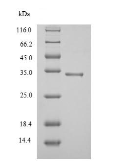 Recombinant Mycobacterium tuberculosis TB Ag85A protein (His tag)