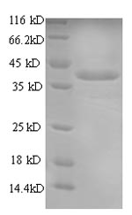 SDS-PAGE - Recombinant Nicotinic Acetylcholine Receptor alpha 1/CHRNA1 protein (Tagged) (AB235797), expandable thumbnail
