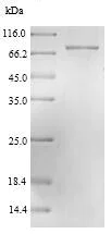 SDS-PAGE - Recombinant Nucleoprotein (His tag) (AB224846)