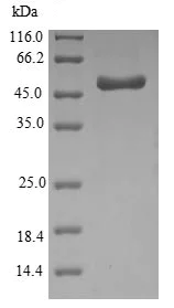 SDS-PAGE - Recombinant OmpA protein (Tagged) (AB226269)
