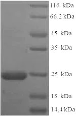 SDS-PAGE - Recombinant OV-16 antigen protein (His tag) (AB225570)