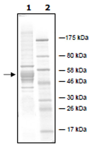 Recombinant P. falciparum PfHDAC1 protein (Active)