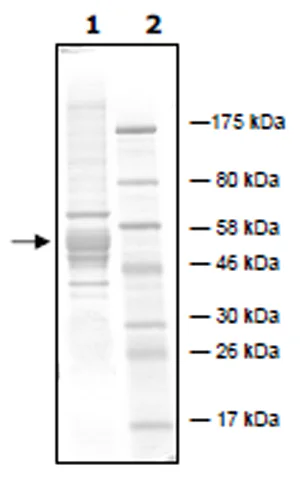 SDS-PAGE - Recombinant P. falciparum PfHDAC1 protein (Active) (DDDDK tag C-Terminus + His tag C-Terminus) (AB271711)