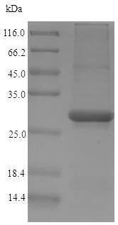 SDS-PAGE - Recombinant Papain protein (His tag) (AB225601)