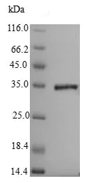 SDS-PAGE - Recombinant Penicillin-binding protein 1A (His tag) (AB225616)