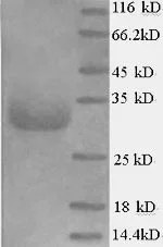 SDS-PAGE - Recombinant Pig EPO protein (His tag) (AB267862)